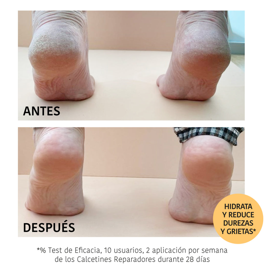Chaussettes Masque Réparateur Pêche
