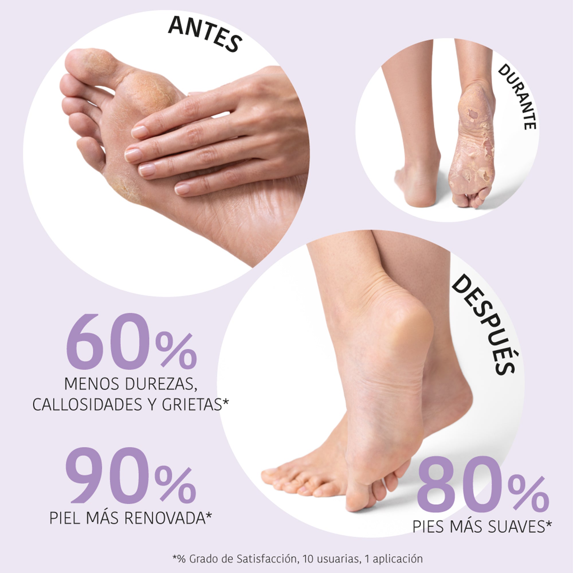 Chaussettes Peeling Exfoliant Acide Glycolique